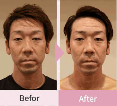 Before After3